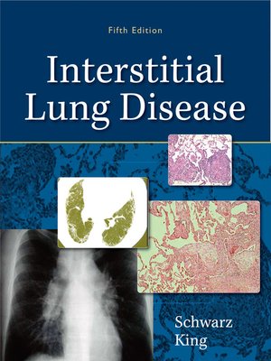 cover image of Interstitial Lung Disease